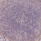 Immunohistochemical staining of human lymph node shows no positivity in germinal center cells as expected.
