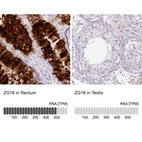 Anti-ZG16 Antibody