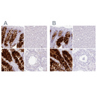 Immunohistochemical staining of human colon, liver, rectum and testis using Anti-ZG16 antibody HPA052512 (A) shows similar protein distribution across tissues to independent antibody HPA052066 (B).
