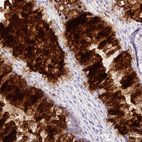 Immunohistochemical staining of human rectum shows strong secreted positivity in glandular cells.