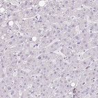 Immunohistochemical staining of human liver shows no positivity in hepatocytes as expected.