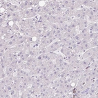 Immunohistochemical staining of human liver shows no positivity in hepatocytes as expected.