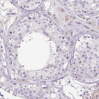 Immunohistochemical staining of human testis shows no positivity in cells in seminiferous ducts as expected.