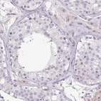 Immunohistochemical staining of human testis shows no positivity in cells in seminiferous ducts as expected.