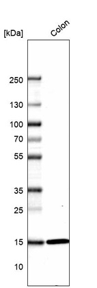 Western blot analysis in human colon tissue.