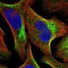Immunofluorescent staining of human cell line U-2 OS shows localization to actin filaments & intermediate filaments.