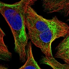 Immunofluorescent staining of human cell line U-2 OS shows localization to actin filaments & intermediate filaments.