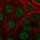 Immunofluorescent staining of human cell line MCF7 shows localization to nucleus.