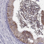Anti-ROPN1B Antibody