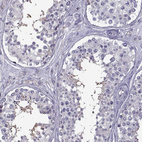 Anti-ROPN1B Antibody