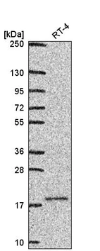 Anti-UBE2V1 Antibody