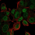 Immunofluorescent staining of human cell line Hep G2 shows localization to nucleoplasm.