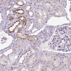 Anti-OR2AK2 Antibody