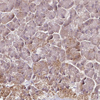 Anti-RPL38 Antibody