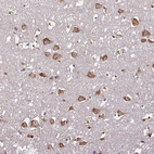 Immunohistochemical staining of human cerebral cortex shows strong cytoplasmic positivity in neuronal cells.