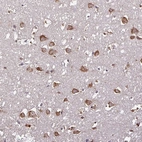 Immunohistochemical staining of human cerebral cortex shows strong cytoplasmic positivity in neuronal cells.