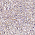 Immunohistochemical staining of human liver shows weak cytoplasmic positivity in hepatocytes.