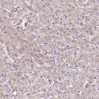 Immunohistochemical staining of human liver shows weak cytoplasmic positivity in hepatocytes.