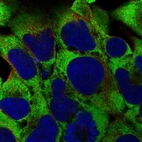 Immunofluorescent staining of human cell line HEK 293 shows localization to cytosol & endoplasmic reticulum.