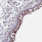 Anti-OR2D3 Antibody