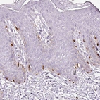 Anti-CYB561A3 Antibody
