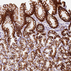 Immunohistochemical staining of human stomach shows strong membranous positivity in glandular cells.