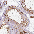 Immunohistochemical staining of human testis shows strong membranous positivity in Sertoli cells.