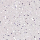 Immunohistochemical staining of human cerebral cortex shows no positivity in neurons as expected.