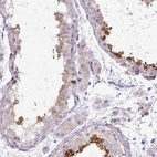 Anti-TBC1D3L Antibody