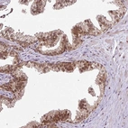Immunohistochemical staining of human prostate shows moderate nuclear positivity in glandular cells.