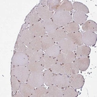Immunohistochemical staining of human skeletal muscle shows moderate nuclear positivity in myocytes.