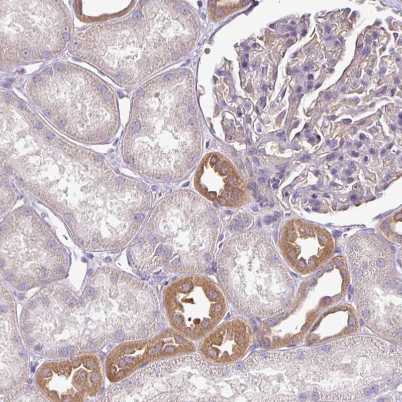 Anti-TMEM107 Antibody