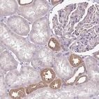 Anti-TMEM107 Antibody