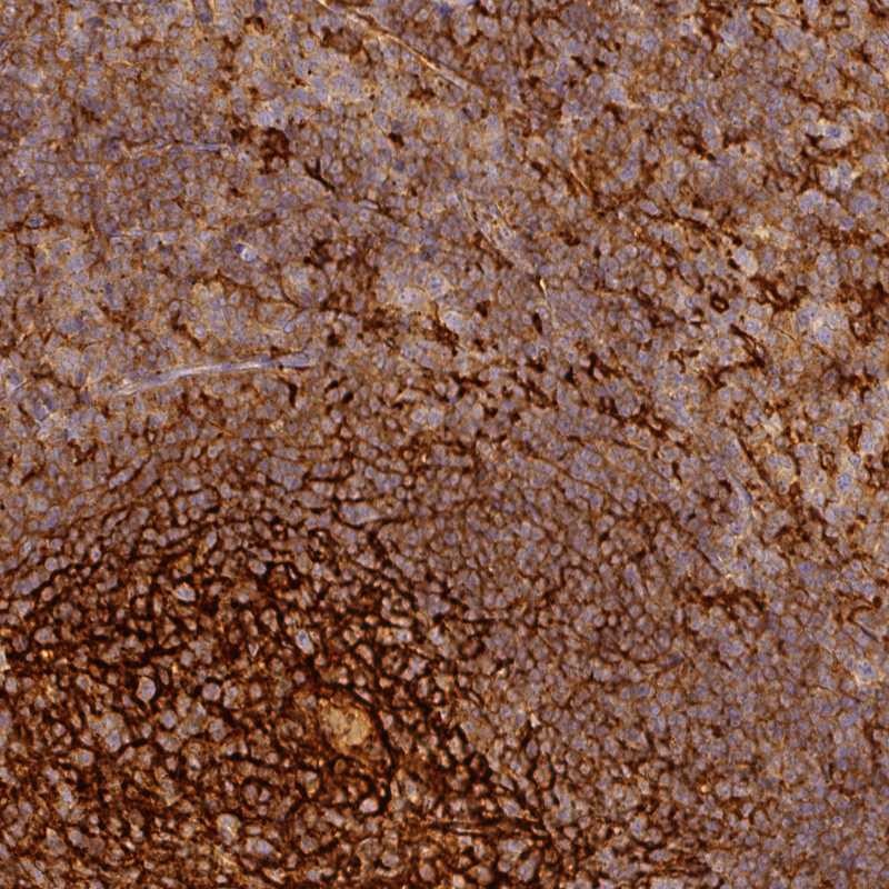 Anti-TMEM42 Antibody