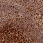 Anti-TMEM42 Antibody