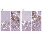 Anti-MME Antibody