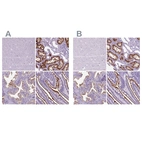 Immunohistochemical staining of human cerebral cortex, kidney, prostate and small intestine using Anti-MME antibody HPA052583 (A) shows similar protein distribution across tissues to independent antibody HPA056072 (B).