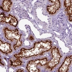 Immunohistochemical staining of human kidney shows strong membranous positivity in cells in tubules.