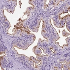 Immunohistochemical staining of human prostate shows strong membranous positivity in glandular cells.