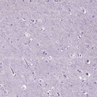 Immunohistochemical staining of human cerebral cortex shows no positivity in neurons as expected.