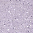 Immunohistochemical staining of human cerebral cortex shows no positivity in neurons as expected.