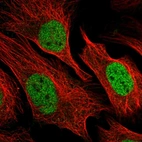 Immunofluorescent staining of human cell line U-2 OS shows localization to nucleoplasm.
