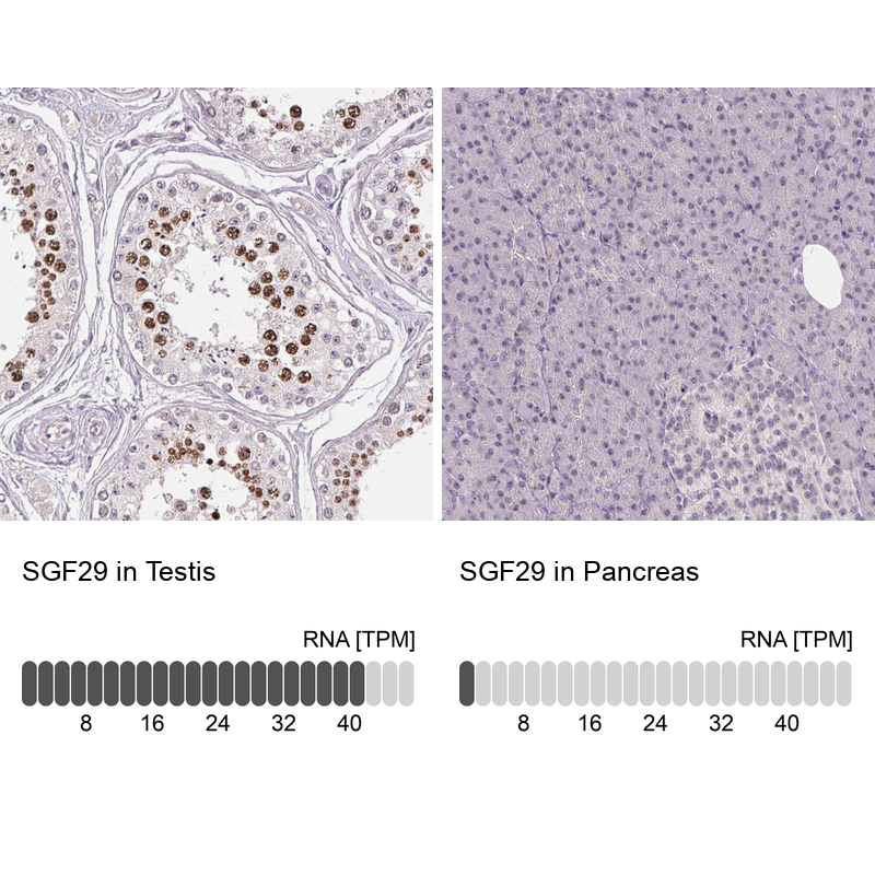 Anti-SGF29 Antibody