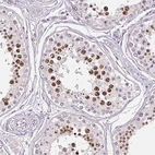 Immunohistochemical staining of human Testis shows strong nuclear positivity in cells in seminiferous ducts.
