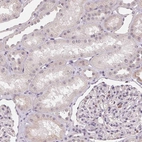 Immunohistochemical staining of human Kidney shows very weak nuclear positivity in cells in tubules.