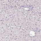 Immunohistochemical staining of human Liver shows very weak nuclear positivity in hepatocytes.