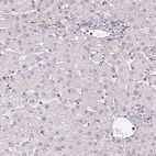 Immunohistochemical staining of human Liver shows very weak nuclear positivity in hepatocytes.