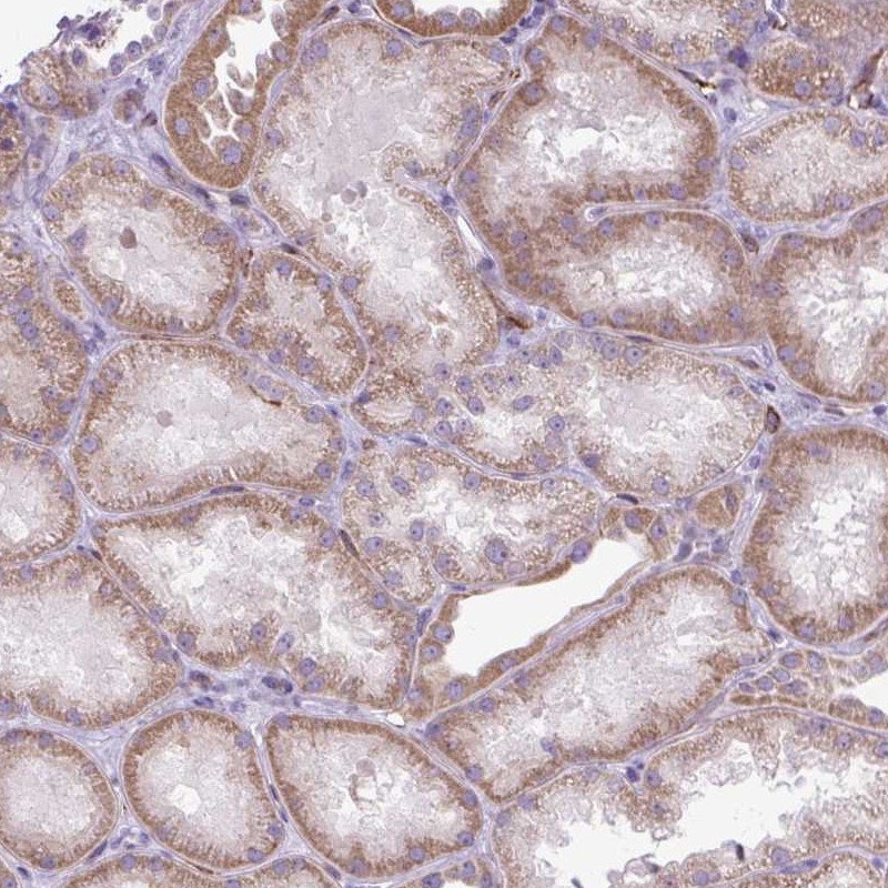 Anti-RNASE10 Antibody