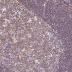 Anti-FAM228B Antibody