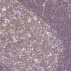 Anti-FAM228B Antibody